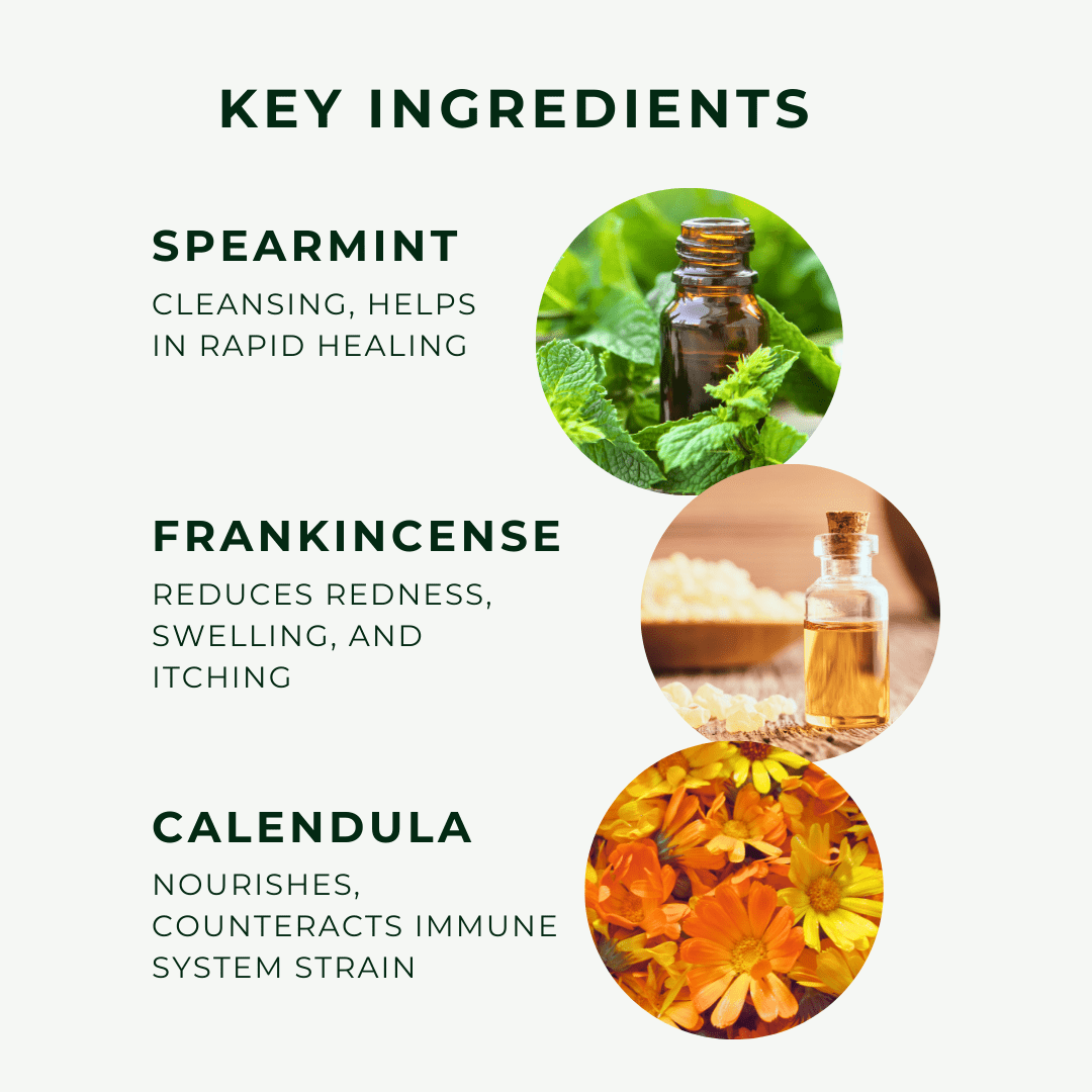 Eczema Scalp Oil w/Calendula